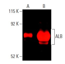 ■SUGAR■様 確認用 セイリン J-Sakura JSPタイプ サクラ 毫鍼 ごうしん SEIRIN鍼