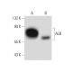 western blotting image from recommended ALB/Albumin (F-10) monoclonal antibody replacement. Image 134776