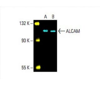 alcamz ALCAM Antibody (B-6) | SCBT - Santa Cruz Biotechnology