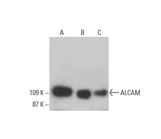 western blotting image from recommended ALCAM (B-6) monoclonal antibody replacement. Image 395702