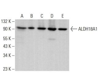 Aldehyde dehydrogenase 18-A1/ALDH18A1 Antibody (G-10) - Western Blotting - Image 382153 