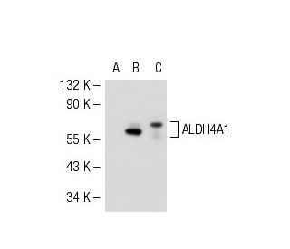 Aldehyde dehydrogenase 4-A1/P5CDH/ALDH4A1 Antibody (672) - Western Blotting - Image 51215