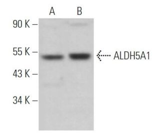 Aldehyde dehydrogenase 5-A1/SSADH/ALDH5A1 Antibody (F-2) - Western Blotting - Image 366830 