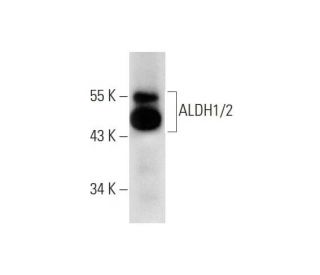 ⬛︎⬛︎なつさま 専用⬛︎⬛︎ Aldehyde dehydrogenase /2/ALDH1A1/2/3/ALDH2 Antibody (H-8