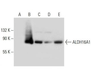 Aldehyde dehydrogenase 16-A1/ALDH16A1 Antibody (C-5) - Western Blotting - Image 308091 