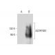 Aldehyde dehydrogenase 16-A1/ALDH16A1 Antibody (C-5) - Western Blotting - Image 308090