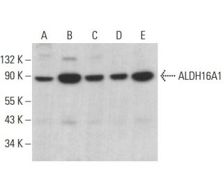 Aldehyde dehydrogenase 16-A1/ALDH16A1 Antibody (E-1) - Western Blotting - Image 382037 