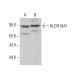 Aldehyde dehydrogenase 16-A1/ALDH16A1 Antibody (F-3) - Western Blotting - Image 376402 