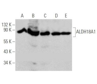 Aldehyde dehydrogenase 18-A1/ALDH18A1 Antibody (G-10) - Western Blotting - Image 349284 