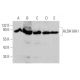 Aldehyde dehydrogenase 18-A1/ALDH18A1 Antibody (G-10) - Western Blotting - Image 349284 