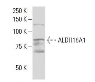 Aldehyde dehydrogenase 18-A1/ALDH18A1 Antibody (QQ19) - Western Blotting - Image 33869