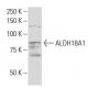 Aldehyde dehydrogenase 18-A1/ALDH18A1 Antibody (QQ19) - Western Blotting - Image 33869
