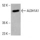 Aldehyde dehydrogenase 1-A1/ALDH1A1 Antibody (A-6) - Western Blotting - Image 415489