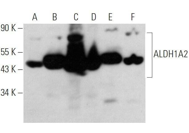 Aldehyde dehydrogenase 1-A2/ALDH1A2 Antibody (G-2) | SCBT