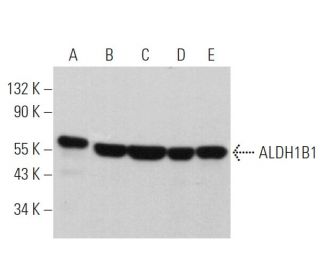 Aldehyde dehydrogenase 1B1/ALDH1B1 Antibody (C-7) - Western Blotting - Image 360654 