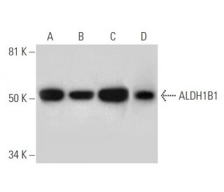 Aldehyde dehydrogenase 1B1/ALDH1B1 Antibody (G-2) - Western Blotting - Image 296922 