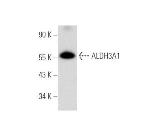 Aldehyde dehydrogenase 3-A1/ALDH3A1 Antibody (E-11) - Western Blotting - Image 316251 