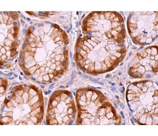 Aldehyde dehydrogenase 3-A1/ALDH3A1 Antibody (G-2) - Immunohistochemistry - Image 374091 