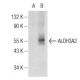 Aldehyde dehydrogenase 3-A2/ALDH3A2 Antibody (G-9) - Western Blotting - Image 147174