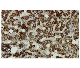 Aldehyde dehydrogenase 4-A1/P5CDH/ALDH4A1 Antibody (672) - Immunohistochemistry - Image 36051 