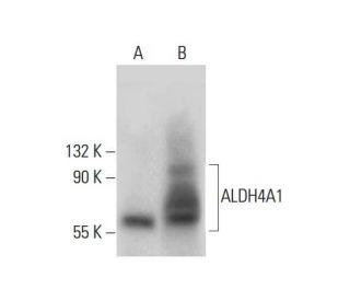 Aldehyde dehydrogenase 4-A1/P5CDH/ALDH4A1 Antibody (E-11) - Western Blotting - Image 308373 