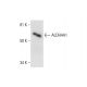 Aldehyde dehydrogenase 4-A1/P5CDH/ALDH4A1 Antibody (E-4) - Western Blotting - Image 294664