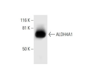 Aldehyde dehydrogenase 4-A1/P5CDH/ALDH4A1 Antibody (E-4) - Western Blotting - Image 295819 