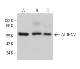 Aldehyde dehydrogenase 4-A1/P5CDH/ALDH4A1 Antibody (F-1) - Western Blotting - Image 365981 