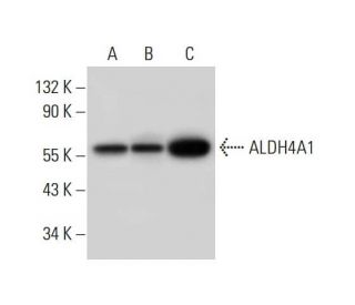 Aldehyde dehydrogenase 4-A1/P5CDH/ALDH4A1 Antibody (H-6) - Western Blotting - Image 309748 