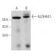 Aldehyde dehydrogenase 4-A1/P5CDH/ALDH4A1 Antibody (H-6) - Western Blotting - Image 366016