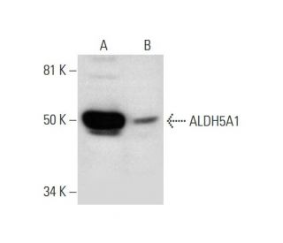 Aldehyde dehydrogenase 5-A1/SSADH/ALDH5A1 Antibody (D-3) - Western Blotting - Image 289813 