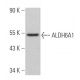 Aldehyde dehydrogenase 6-A1/ALDH6A1 Antibody (A-6) - Western Blotting - Image 367383