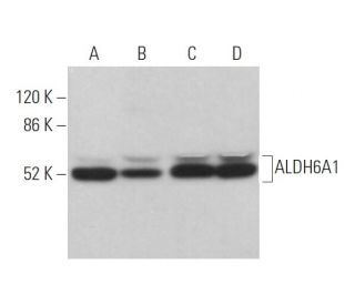 Aldehyde dehydrogenase 6-A1/ALDH6A1 Antibody (C-9) - Western Blotting - Image 372560 