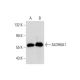 Aldehyde dehydrogenase 6-A1/ALDH6A1 Antibody (G-10) - Western Blotting - Image 299232