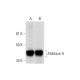 western blotting image from recommended Aldolase A (C-10) monoclonal antibody replacement. Image 289617