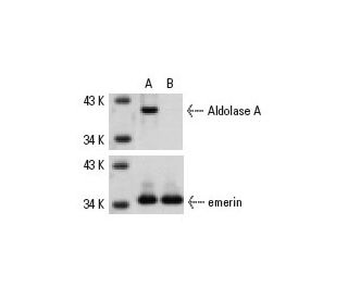 Aldolase A siRNA (h): sc-29664. Western blot analysis of Aldolase A expression in non-transfected control (A) and Aldolase 