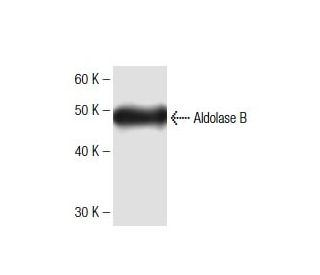 Aldolase B Antibody (19) - Western Blotting - Image 136750 