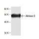 Aldolase B Antibody (19) - Western Blotting - Image 136750 