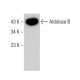 Aldolase B Antibody (19) - Western Blotting - Image 382247