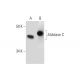 Cet anticorps polyclonal n'est plus commercialisé. Voir l'anticorps monoclonal <a href="aldolase-c-antibody-h-11">Aldolase C (H-11)</a> que nous recommandons (données d'échantillonnage indiquées). western blotting image from recommended Aldolase C (H-11) monoclonal antibody replacement. Image 289809