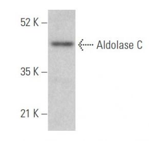 Aldolase C Antibody (H-11) - Western Blotting - Image 354636Each CRISPR/Cas9 Knockout (KO) Plasmid product consists of a pool of 3 plasmids designed to ensure identification and cleavage of a specific gene for maximum knockout efficiency. Each plasmid encodes a unique 20 nt sequence derived from the GeCKO (v2) library. 