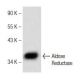 Aldose Reductase Antibody (E-12) - Western Blotting - Image 147303 
