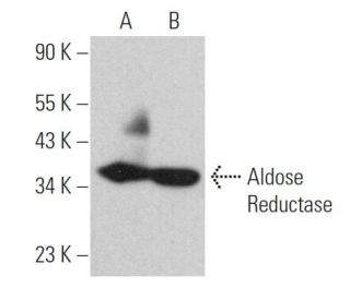 Aldose Reductase Antibody (F-10) - Western Blotting - Image 363463 