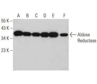 western blotting image from recommended Aldose Reductase (H-6) monoclonal antibody replacement. Image 381121