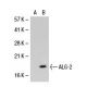 ALG-2 Antibody (AA8) - Western Blotting - Image 21993
