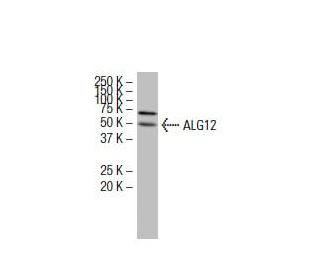 ALG12 Antibody (Q16) - Western Blotting - Image 33880 