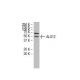 ALG12 Antibody (Q16) - Western Blotting - Image 33880 