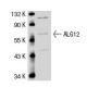 ALG12 Antibody (Q16) - Western Blotting - Image 47372 