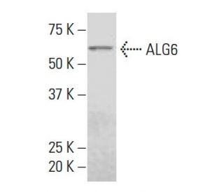ALG6 Antibody (Z164) - Western Blotting - Image 33879
