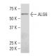 ALG6 Antibody (Z164) - Western Blotting - Image 33879